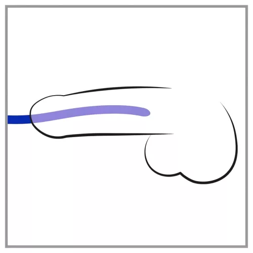 You2Toys - DILATOR - szilikon dilátor szett (3 db)