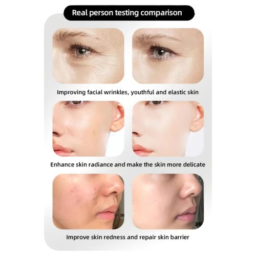 / Photon Rejuvenation Arcápoló LED maszk