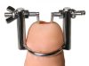 Stretcher – 3,5 cm-es húgycső tágító eszköz