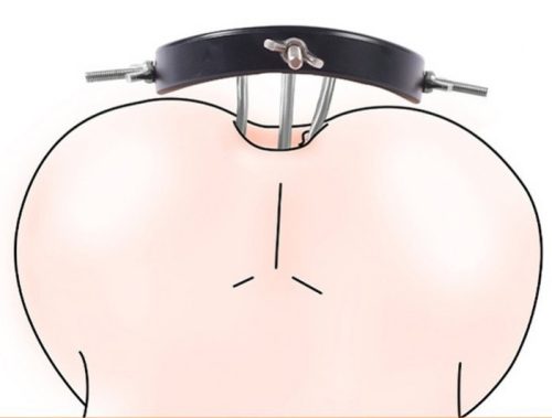 Xtreme anális tágító – prémium 11 cm átmérőjű eszköz