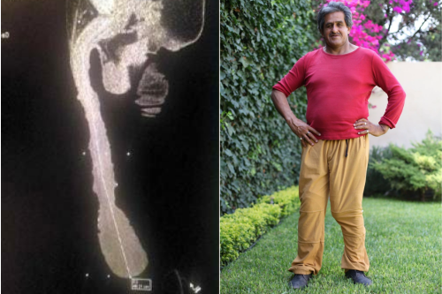 48_CENTIS_MERET_500x333px_01.png